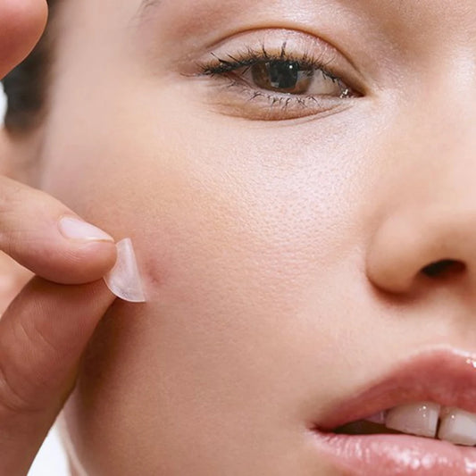 Acne Clearing Pimple Patches (Pack of 2, 72 Pcs)