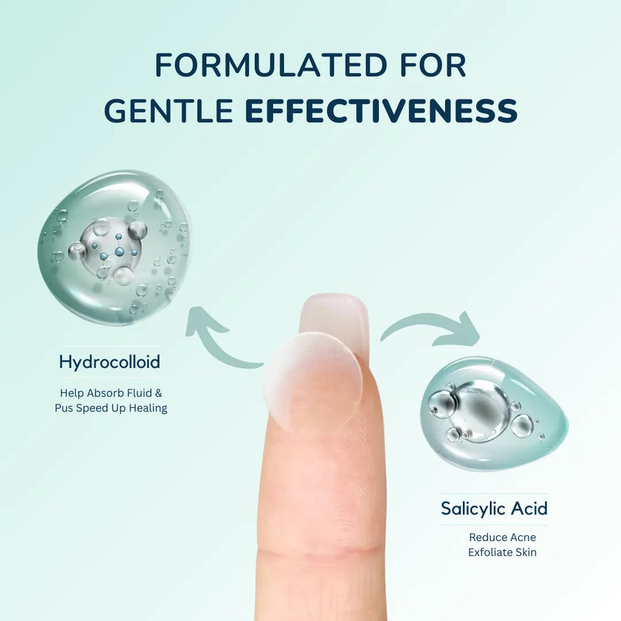 Acne Clearing Pimple Patches