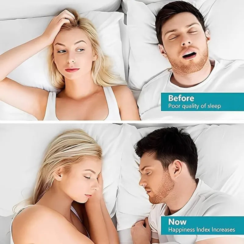 Anti Snoring Device for Men and Women (2 Pcs)